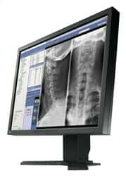 نمایشگر پزشکی Medical LED، LCD ایزو RadiForce MX21055744thumbnail